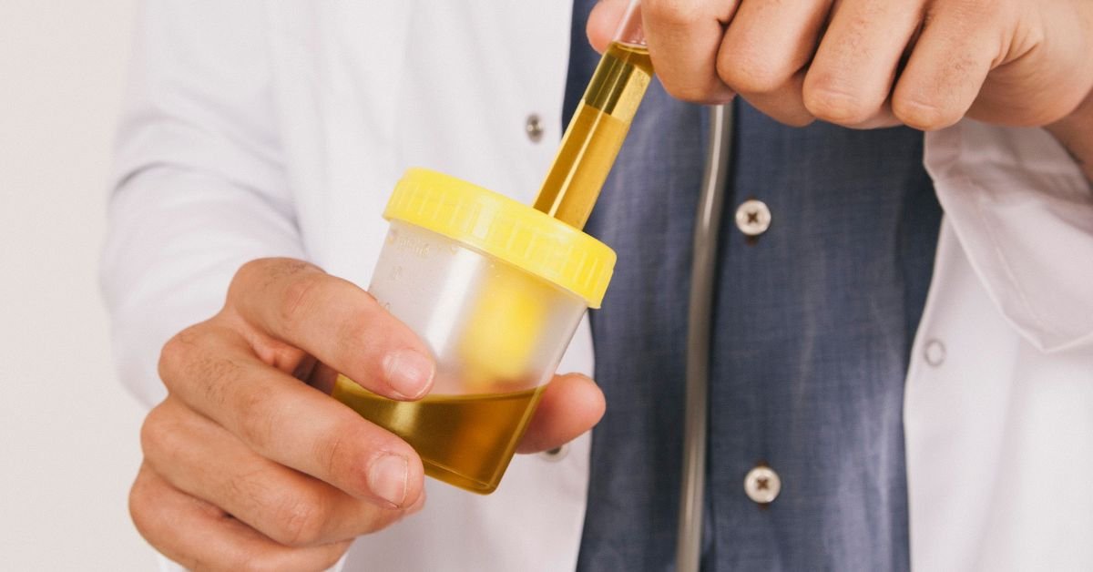 Urine in Dreams Hidden Meanings You Should Know Urine in Dreams Hidden Meanings You Should Know